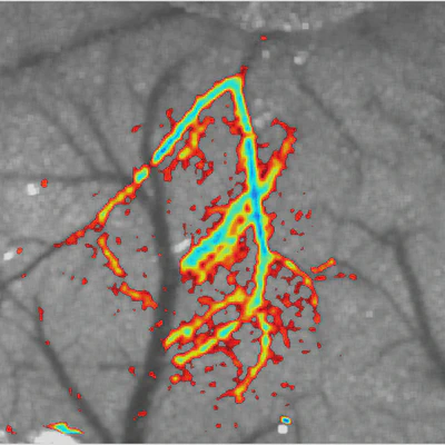 **Using a webcam to perform LSCI:** Post-stroke blood flow deficit imaged using an inexpensive LSCI system comprised of a webcam, plastic aspheric lenses, and a laser pointer. This image shows baseline speckle contrast imagery overlaid with the percent reduction in blood flow following a stroke in a mouse. ([Richards, 2013](/publication/richards-2013/)).