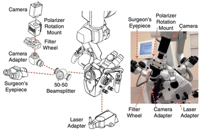 Schematic of hardware adapted to Zeiss OPMI Pentero neurosurgical microscope for intraoperative LSCI ([Richards, 2017](/publication/richards-2017/)).