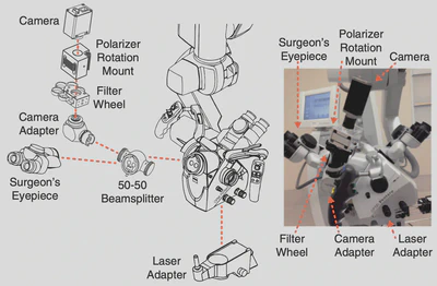 Schematic of hardware adapted to Zeiss OPMI Pentero neurosurgical microscope for intraoperative LSCI ([Richards, 2017](/publication/richards-2017/)).