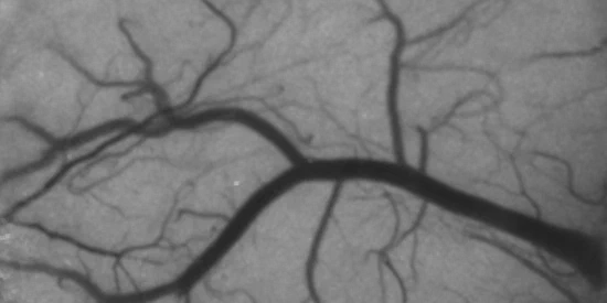 Laser Speckle Contrast Imaging