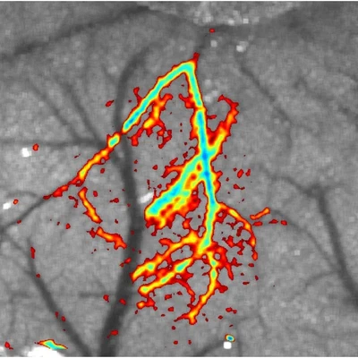 **Using a webcam to perform LSCI:** Post-stroke blood flow deficit imaged using an inexpensive LSCI system comprised of a webcam, plastic aspheric lenses, and a laser pointer. This image shows baseline speckle contrast imagery overlaid with the percent reduction in blood flow following a stroke in a mouse. ([Richards, 2013](/publication/richards-2013/)).