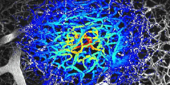 Modeling Light Propagation