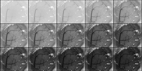 Multi-Exposure Speckle Imaging