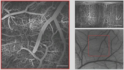 **Large field-of-view imaging with resonant scanner:** Top and side maximum intensity projections of large stack ($1160\times1160$ µm) created by stitching together multiple two-photon acquisitions. Speckle contrast image of surrounding surface vasculature ([Engelmann, 2022](/publication/engelmann-2022)).