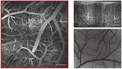 **Large field-of-view imaging with resonant scanner:** Top and side maximum intensity projections of large stack ($1160\times1160$ µm) created by stitching together multiple two-photon acquisitions. Speckle contrast image of surrounding surface vasculature ([Engelmann, 2022](/publication/engelmann-2022)).