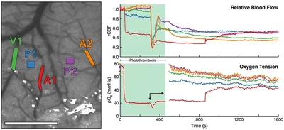 **Multimodal Hemodynamic Imaging:** Blood flow and oxygen tension imaged simultaneously during and after photothrombotic stroke. An arteriole (A1/red) was occluded using DMD-targeted photothrombosis to induce ischemic stroke. ([Sullender, 2018](/publication/sullender-2018/)).