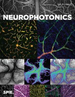 Continuous blood flow visualization with laser speckle contrast imaging during neurovascular surgery