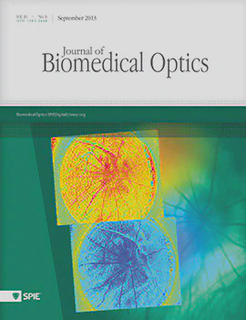 Featured on cover of *Journal of Biomedical Optics*